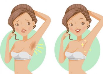 Cách trị thâm nách và một số lưu ý cần nhớ để “vùng cánh” luôn trắng xinh mịn màng