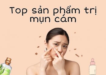 TOP 10 sản phẩm trị mụn cám hiệu quả nhất hiện nay: mụn “lì đến đâu” cũng phải chịu thua