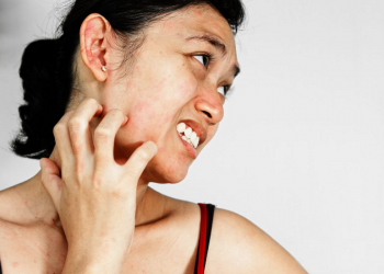 Ghẻ nước là bệnh gì? Bệnh ghẻ nước có nguy hiểm không?