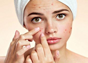 Chuyên gia dinh dưỡng tư vấn: Da mụn ăn rau nên ăn gì?