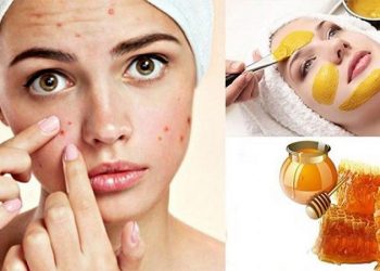 Các cách điều trị mụn bọc ở nhà rẻ tiền, hiệu quả, ai cũng làm được