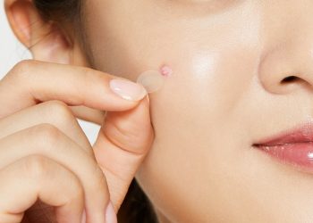 Trước khi dùng cần biết: liệu miếng dán mụn có thật sự hiệu quả