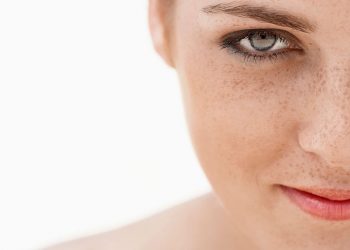 Nám nội tiết là gì, có biểu hiện ra sao và đối phó bằng cách nào