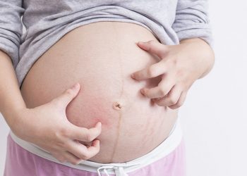 Một số trường hợp dị ứng khi đang mang thai và mức độ nguy hiểm