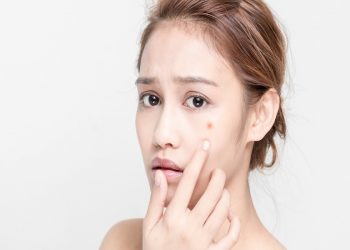 Bí kíp chăm sóc da sau khi nặn mụn để làn da luôn căng bóng