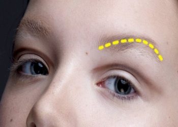 Hóa giải nỗi lo: Rụng lông mày phải làm thế nào?