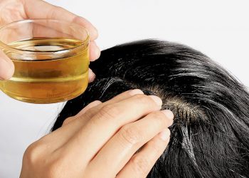 Nguyên nhân, triệu chứng và cách trị nấm da đầu triệt để