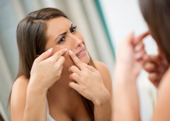 Điều trị mụn đầu trắng sao cho hiệu quả?