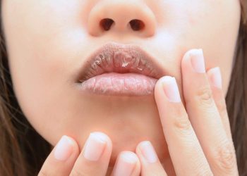 Tổng hợp những các phương pháp điều trị thâm môi hiệu quả