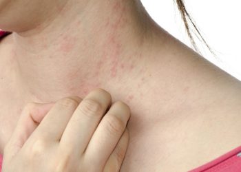 Mách bạn cách khắc phục tình trạng bị ngứa khắp người không rõ nguyên nhân