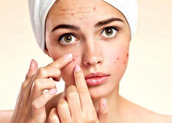 Vị trí nổi mụn nói lên điều gì – bác sĩ Da liễu tư vấn cụ thể