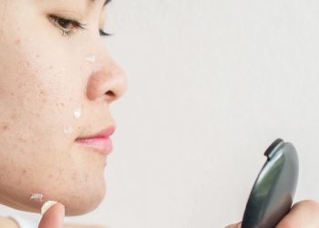Chuyên gia hướng dẫn cách chăm sóc da mụn vào mùa đông