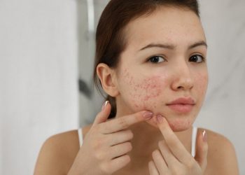 Điểm danh 7 dấu hiệu cho thấy bạn bị dị ứng mỹ phẩm