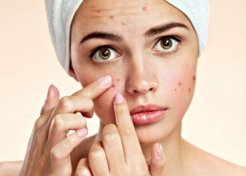 Tìm hiểu đặc điểm mụn viêm và cách xử lý “nhanh gọn”
