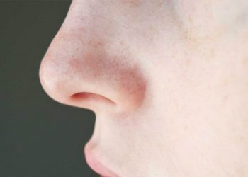 Tắc lỗ chân lông là gì và nguyên nhân dẫn đến tình trạng này