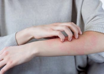 ​Nguyên nhân gây ngứa da mùa lạnh và xử lý an toàn