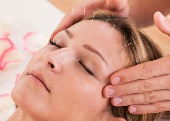 #4 tác dụng cải thiện nhan sắc bất ngờ của châm cứu