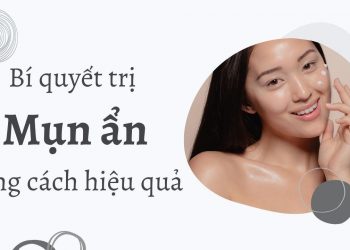 Mụn ẩn là gì? Chia sẻ cách trị mụn ẩn với các thành phần treatment hiệu quả nhất