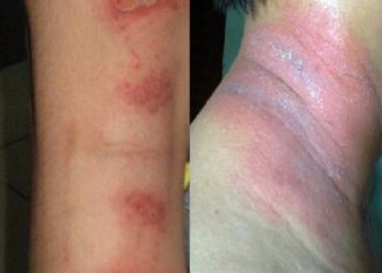 Cách đuổi kiến ba khoang đơn giản tại nhà, ai ở chung cư nên học ngay