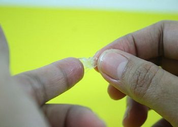 Cách xử lý khi bị dính keo 502 hiệu quả nhất ít ai biết