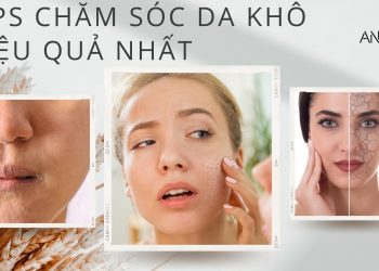 Bật mí các tips chăm sóc da khô hiệu quả nhất: hết ngay bong tróc, da mềm mại căng mịn