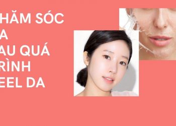 Chi tiết cách chăm sóc da sau peel, giúp da mau chóng phục hồi tránh để lại hậu quả
