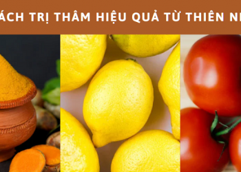 10 cách trị thâm mụn tại nhà cho da dầu đơn giản nhất