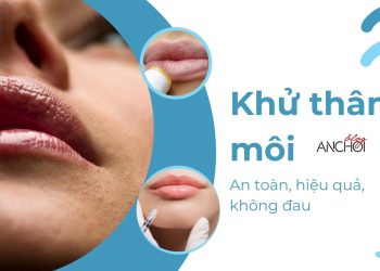 Có nên khử thâm môi tại spa? Các phương pháp khử thâm môi hiệu quả dành cho mọi cô nàng