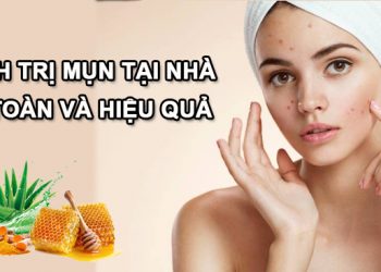 10 cách trị mụn tại nhà an toàn, hiệu quả