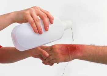 Biện pháp sơ cứu khi trẻ bị động vật tấn công nhất định phải biết