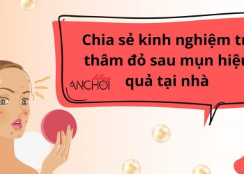 Thâm đỏ sau mụn là gì ? Chia sẻ kinh nghiệm trị thâm đỏ đúng cách
