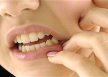 Một vài mẹo nhỏ giúp giảm đau hữu hiệu do mọc răng khôn
