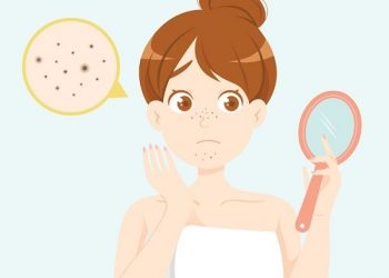10 công thức mặt nạ DIY giúp loại bỏ mụn đầu đen