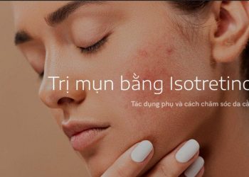 Chia sẻ kinh nghiệm trị mụn trứng cá bằng Isotretinoin đơn giản, hiệu quả nhanh