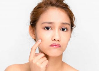 Top 5 sản phẩm kem trị mụn hiệu quả “cứu cánh” cho làn da của bạn tức thì