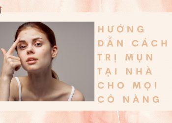 Hướng dẫn cách trị mụn tại nhà bằng những nguyên liệu sẵn có: đơn giản, hiệu quả cao
