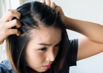 Nguyên nhân và cách khắc phục rụng tóc từng mảng hiệu quả