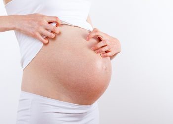 Điều trị viêm da cơ địa khi mang thai như thế nào để không ảnh hưởng đến thai nhi