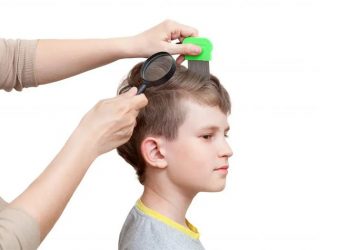 ​Tại sao trẻ bị rụng tóc nhiều và hướng xử lý như thế nào?