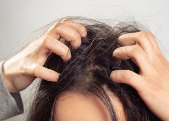 Nguyên nhân và cách trị nấm da đầu hiệu quả