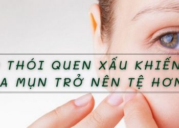 9 thói quen xấu khiến da mụn trở nên tệ hơn