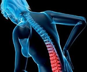 Một vài gợi ý nhỏ giúp phòng tránh loãng xương hiệu quả