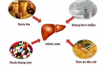 Bí quyết giúp thanh nhiệt, trị nóng gan mùa hè hiệu quả