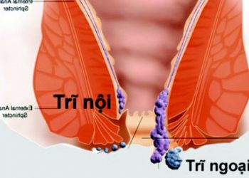 khó hay dễ nguyên nhân do đâu?