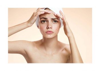 Bật mí 5 điều hiểu lầm về da dầu mụn không phải ai cũng biết