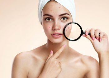 5 loại kem trị thâm mụn hiệu quả, giá sinh viên