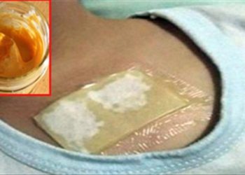 Dứt cơn ho sau 1 đêm bằng đắp mật ong, dầu oliu: Có là thật?