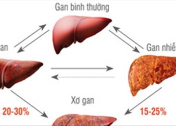 Cực sai lầm cần tránh để kéo dài sự sống