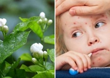 Mách bạn cách trị sởi bằng bài thuốc dân gian nhiều người chưa biết