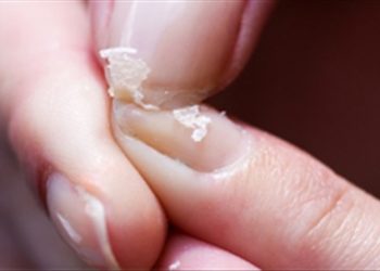 Hỗn hợp dễ làm thế này sẽ là cứu cánh!